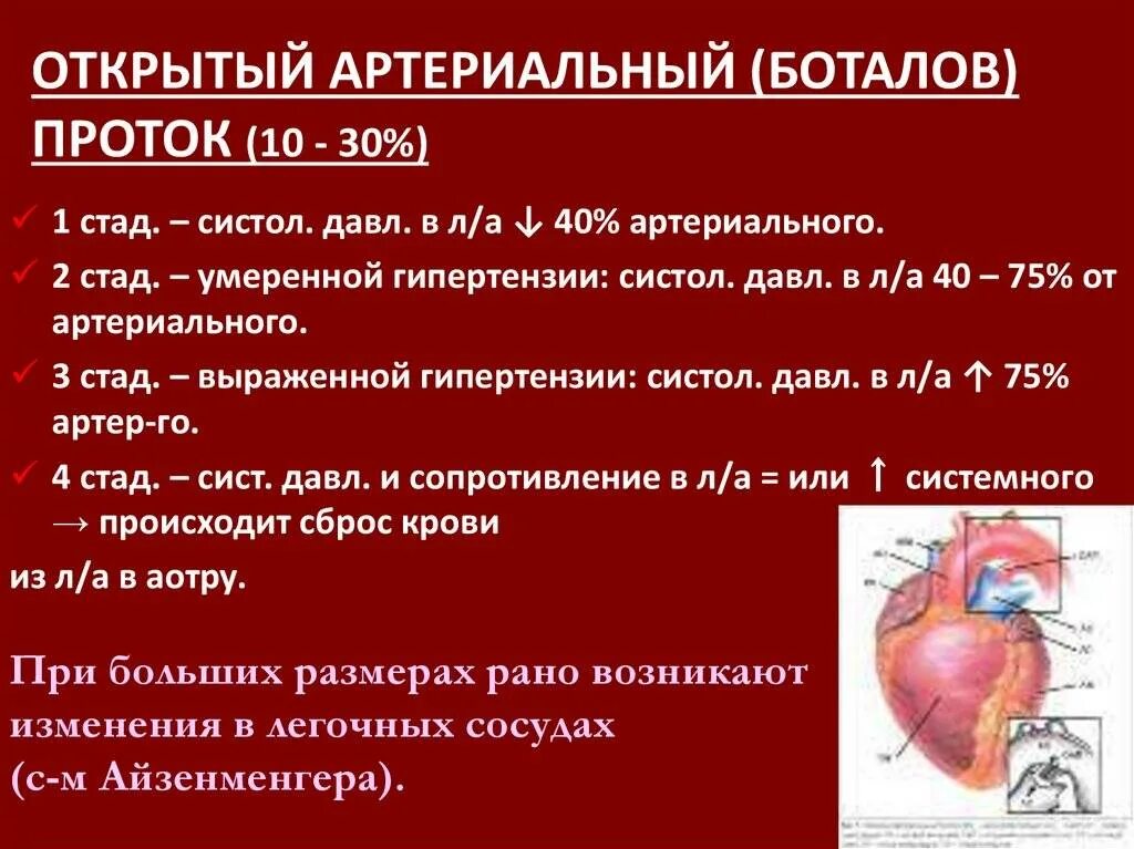 Впс оап. Впс открытый артериальный проток у детей. боталлов проток (артериальный проток). врожденный порок сердца открытый артериальный проток. открытый артериальный (боталлов).