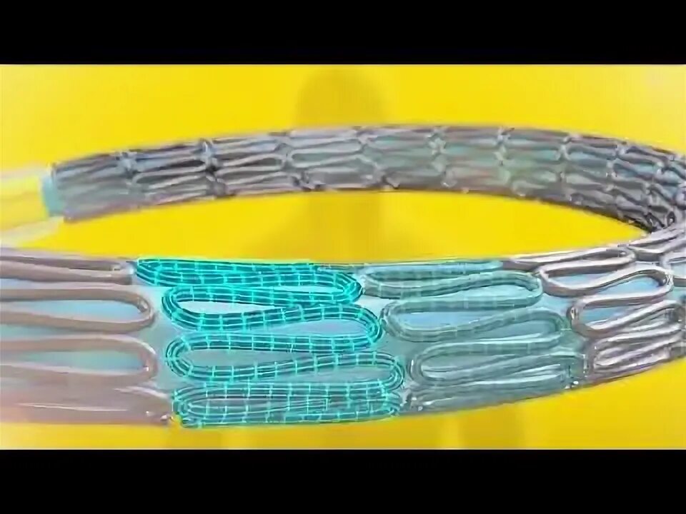 Resolute integrity стент производитель. Resolute integrity стент. Resolute integrity стент. Коронарный стент resolute integrity. Resolute integrity стент.