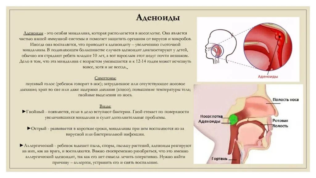 Болит носоглотка что делать