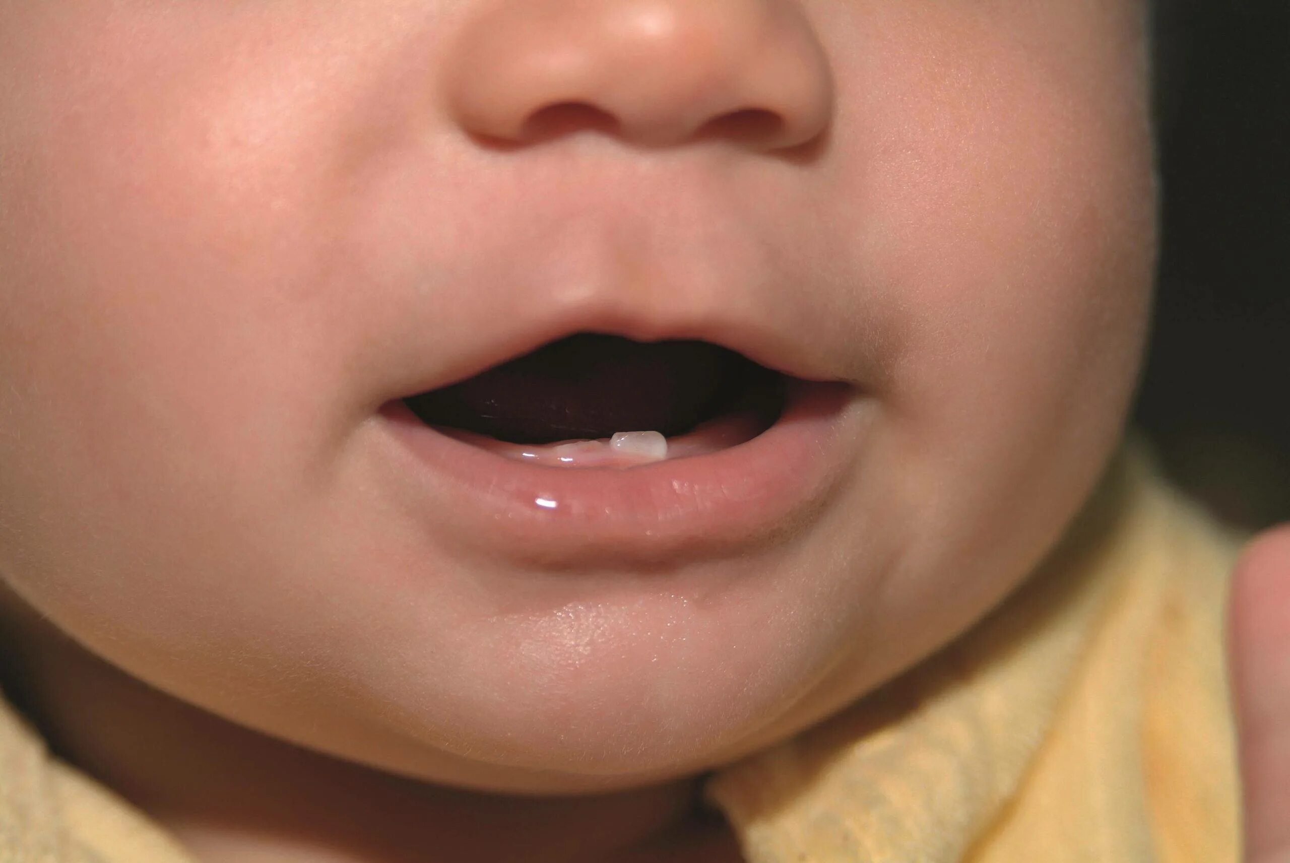 Первый зуб возраст. Прорезывание зубов у младенцев. Прорезание первых зубов.
