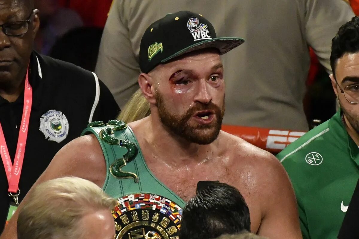 Цыганский король тайсон. Тайсон фьюри с уайлдер бой. Тайсон фьюри диллиан уайт бой. Сколько заработал фьюри за бой. Сколько заработал фьюри за бой.