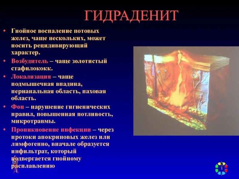 Воспаление железы называется. Воспаление потовой железы. воспаление апокринных потовых желез. гнойное воспаление потовых желез.