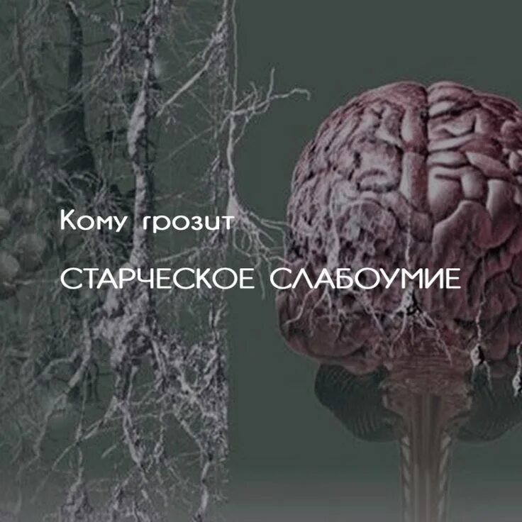 Мозг слабоумие. Старческое слабоумие мозг. Постеры плакаты старческое слабоумие. Старческая псевдомеланхолия.