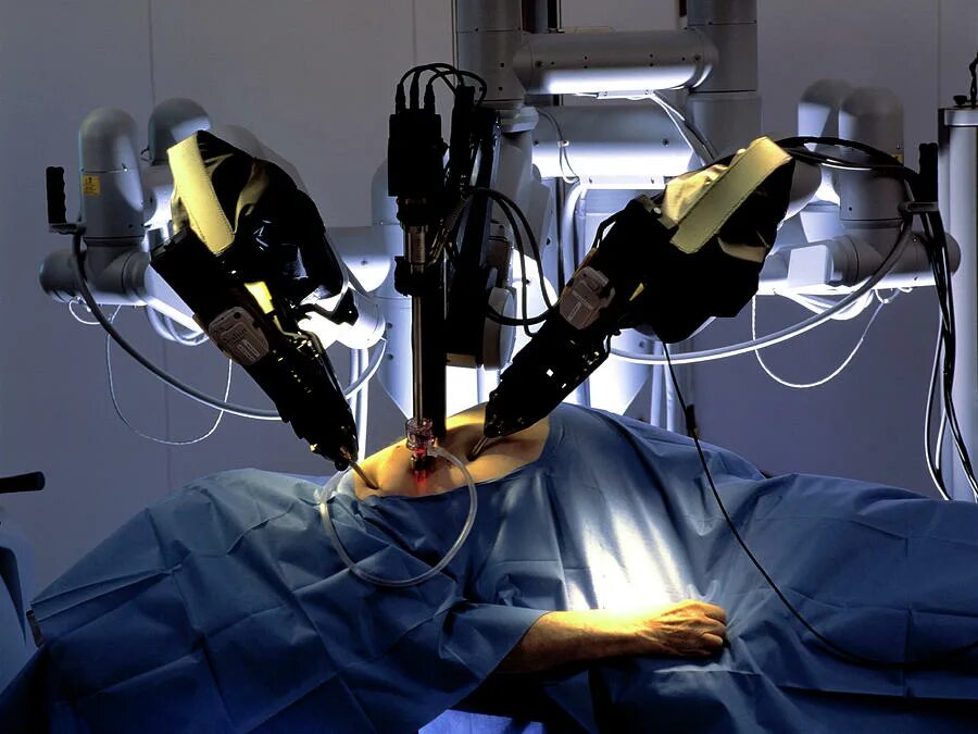 Да винчи операция простата. Робот хирург да Винчи. Робот-хирург da Vinci в России. DAVINCI робот хирургия.