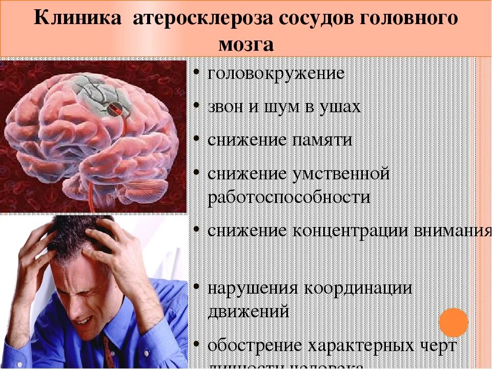 Атеросклероз сосудов головного мозга. Атеросклероз артерий головного мозга. Клинические проявления атеросклероза мозговых артерий. Атеросклероз сосудов головного мозга симптомы. Головокружение снижение памяти