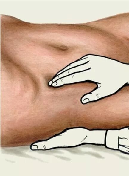Аппендицит блюмберга симптомы. Симптом щеткина блюмберга. положительный синдром щеткина блюмберга. синдром щеткина -блюмберга это. щеткина блюмберга положительный.