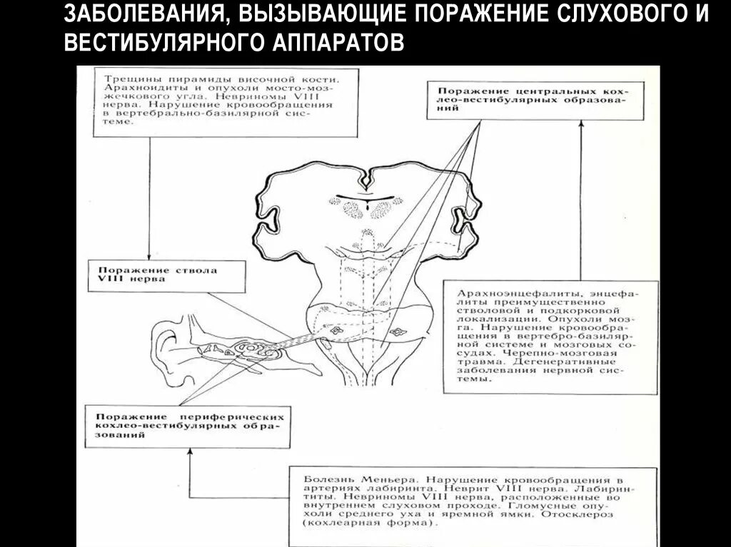 Нарушение вестибулярного аппарата лечение у взрослого. Поражение вестибулярного аппарата. Заболевание вестибулярного аппарата статистика. Болезни связанные с вестибулярным аппаратом. Проблемы с вестибулярным аппаратом симптомы.