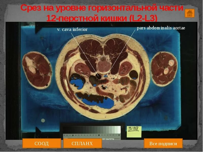 Срез работ. Поперечный срез тела человека. анатомический срез человека.