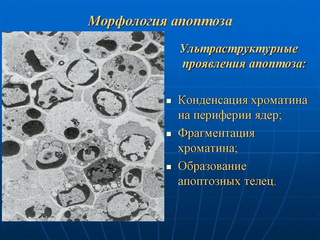 Апоптоз микроскопические проявления. Апоптоз конденсация хроматина. Апоптоз Электронограмма. Апоптоз морфологические изменения.