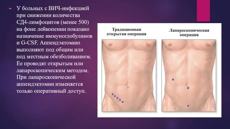 Аппендицит низ. Актуальность аппендицита. Предвестники аппендицита.