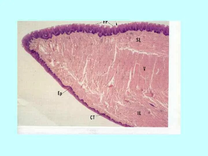 Грибовидные сосочки гистология препарат. Нитевидные сосочки гистология. Нитевидные сосочки языка гистология. Язык срез. Нитевидные сосочки гистология препарат.