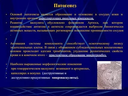 Типа феномена артюса