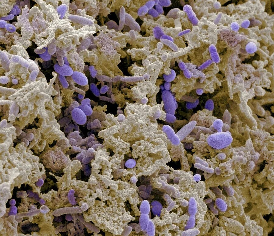 Как выглядит под названием. Еда под микроскопом. Бактерии в микроскопе. Ковид бактерии микроскоп. Микробы под микроскопом для детей.