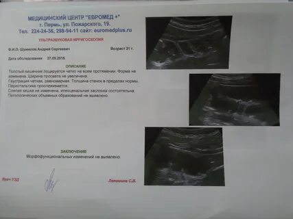 Можно делать узи после колоноскопии