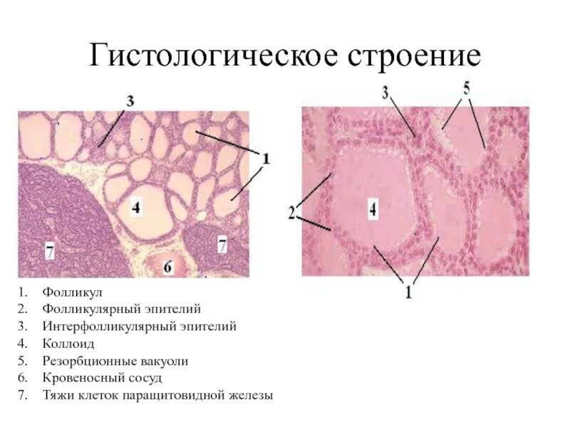 Паращитовидная железа гистология препарат. Фолликулярный эпителий. Фолликулярный эпителий. Щитовидная железа фолликул тироциты. Клетки паращитовидной железы гистология.