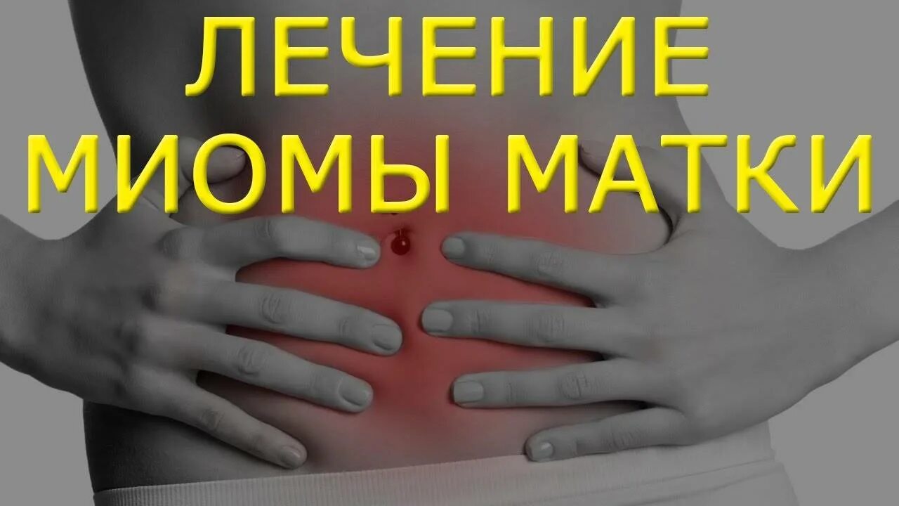 Как лечить миому матки без операции. Лекарство миомы лв 8 в 8. миома матки лечение видео.