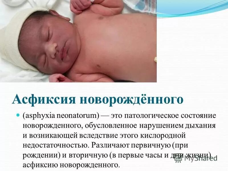 Родились в асфиксии. Асфиксия новорожденных. причины вторичной асфиксии новорожденных. клинические проявления асфиксии новорожденных. • асфиксияноворожденный.