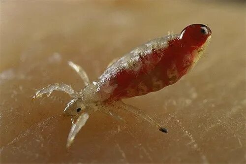Бельевая вша как выглядят укусы Helminths/Arthropods Plastic Surgery Key