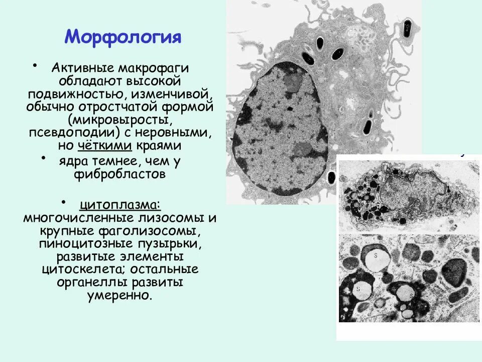 Фаголизосомы. Структурные типы ядрышек. Функция фаголизосомы. Клетка в цитоплазме которой много фаголизосом.