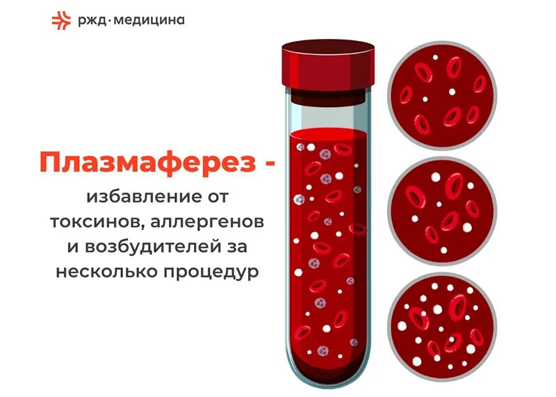 Дискретный плазмаферез. Детоксикационный плазмаферез. Селективная плазмофильтрация. Плазмаферез. Реклама плазмафереза.