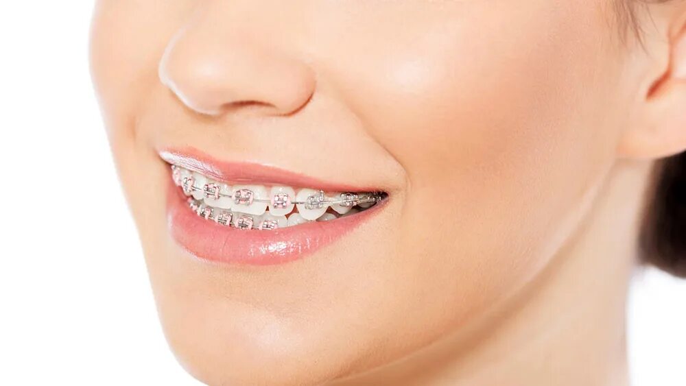 Matching brackets