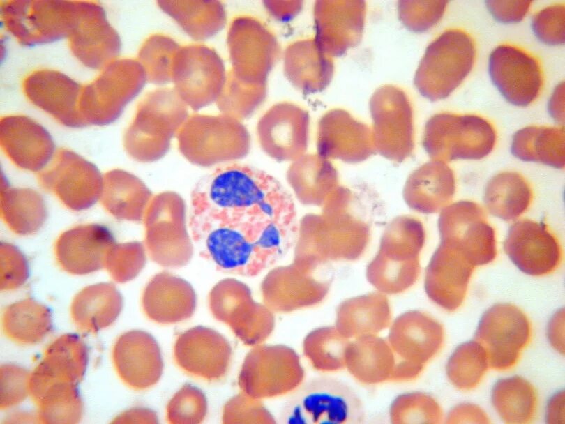 Эозинофилы клинический анализ крови норма. Эозинофилы в микроскоп. Эозинофилы у собаки. Эозинофилы у собаки. Эозинофилы расшифровка анализа крови.