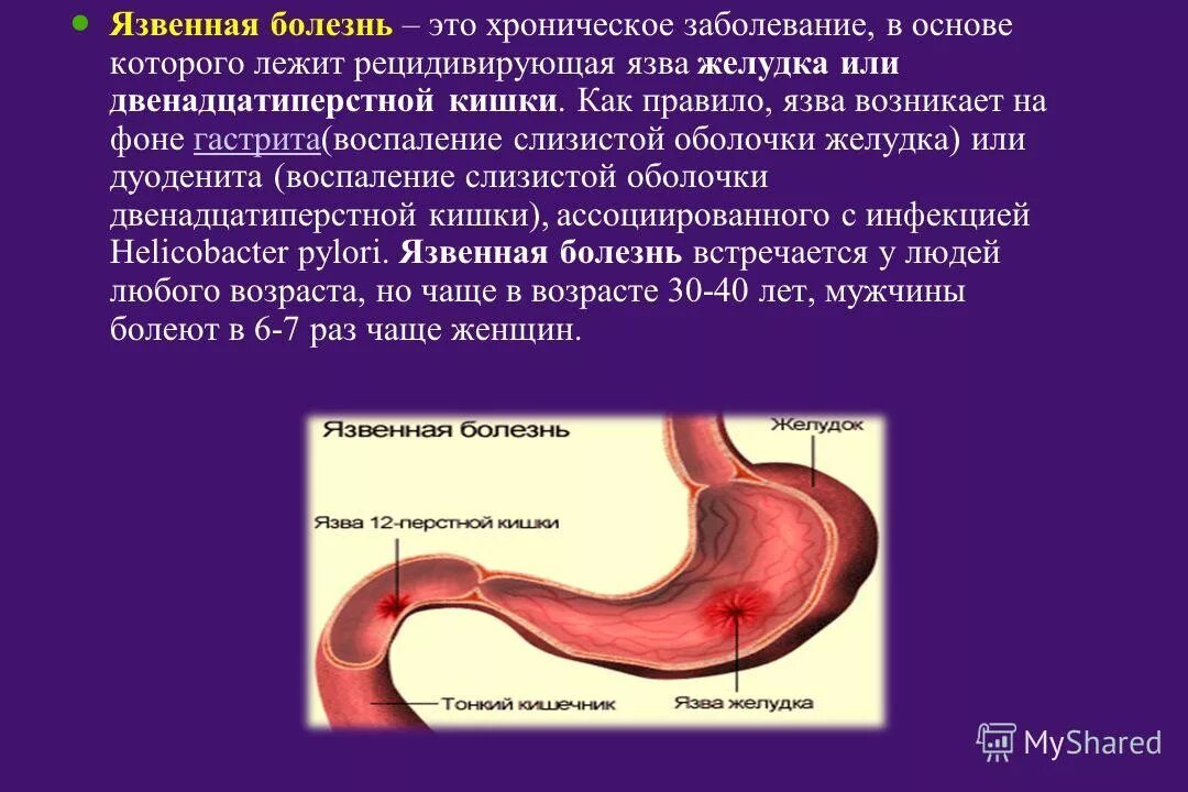 Заболевания желудка человека. Язвенная болезнь болезнь желудка и 12 перстной кишки. Язвенная болезнь 12 перстной кишки специфические симптомы. Характерным симптомом язвы ДПК является. Проявления язвенной болезни желудка и 12-перстной кишки..