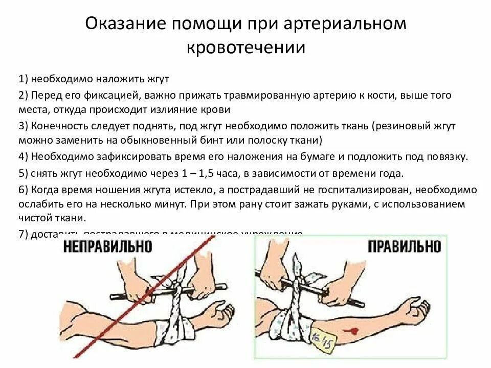 При сильном кровотечении нужно. Алгоритм оказания помощи при артериальном кровотечении. Наложение артериального жгута алгоритм. Порядок действия при артериальном кровотечении алгоритм. Остановка артериального кровотечения алгоритм кратко.