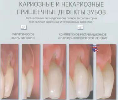 Поднималась почему и