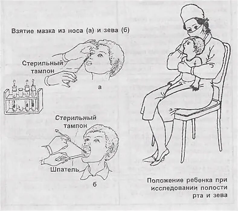 Взятие мазка из носа алгоритм. Взятие мазка из зева и носа. техника взятия мазка из зева и носа. взятие мазка из зева у детей. мазок из зева и носа у детей.