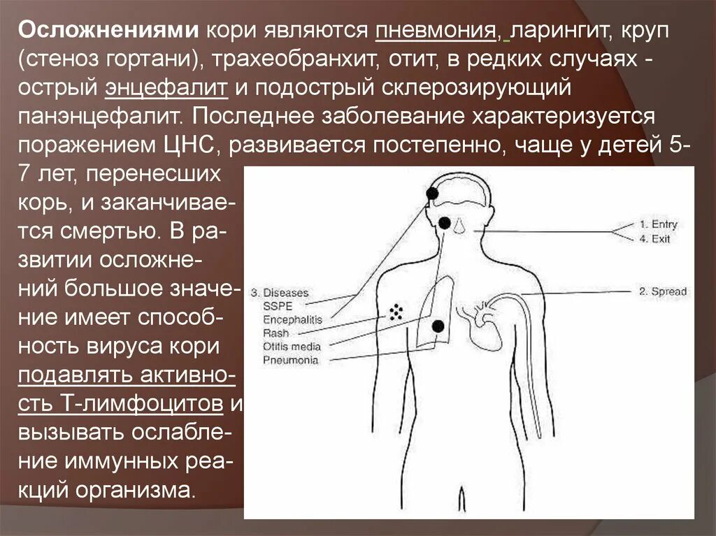 Эпидемиологическими особенностями кори являются тест с ответами. Корь особенности течения кратко. Ранние и поздние осложнения кори. Осложнения от прививки от кори у взрослых. Осложнениями кори являются.