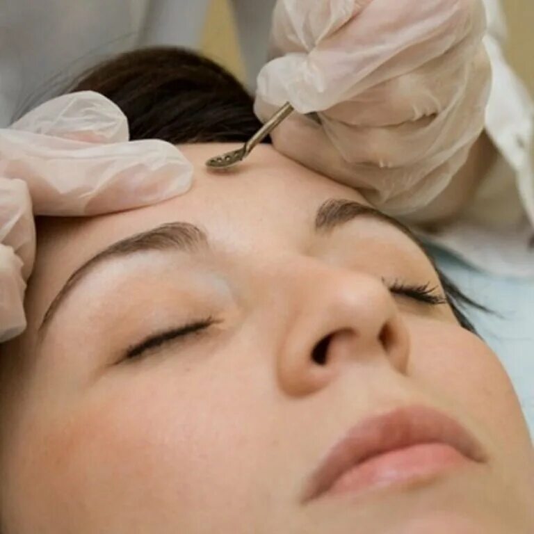 лицо косметология. косметолог 1 видео выдавливание. косметолог 1 видео выдавливание. мануальная чистка лица фото. комбинированная чистка лиу.