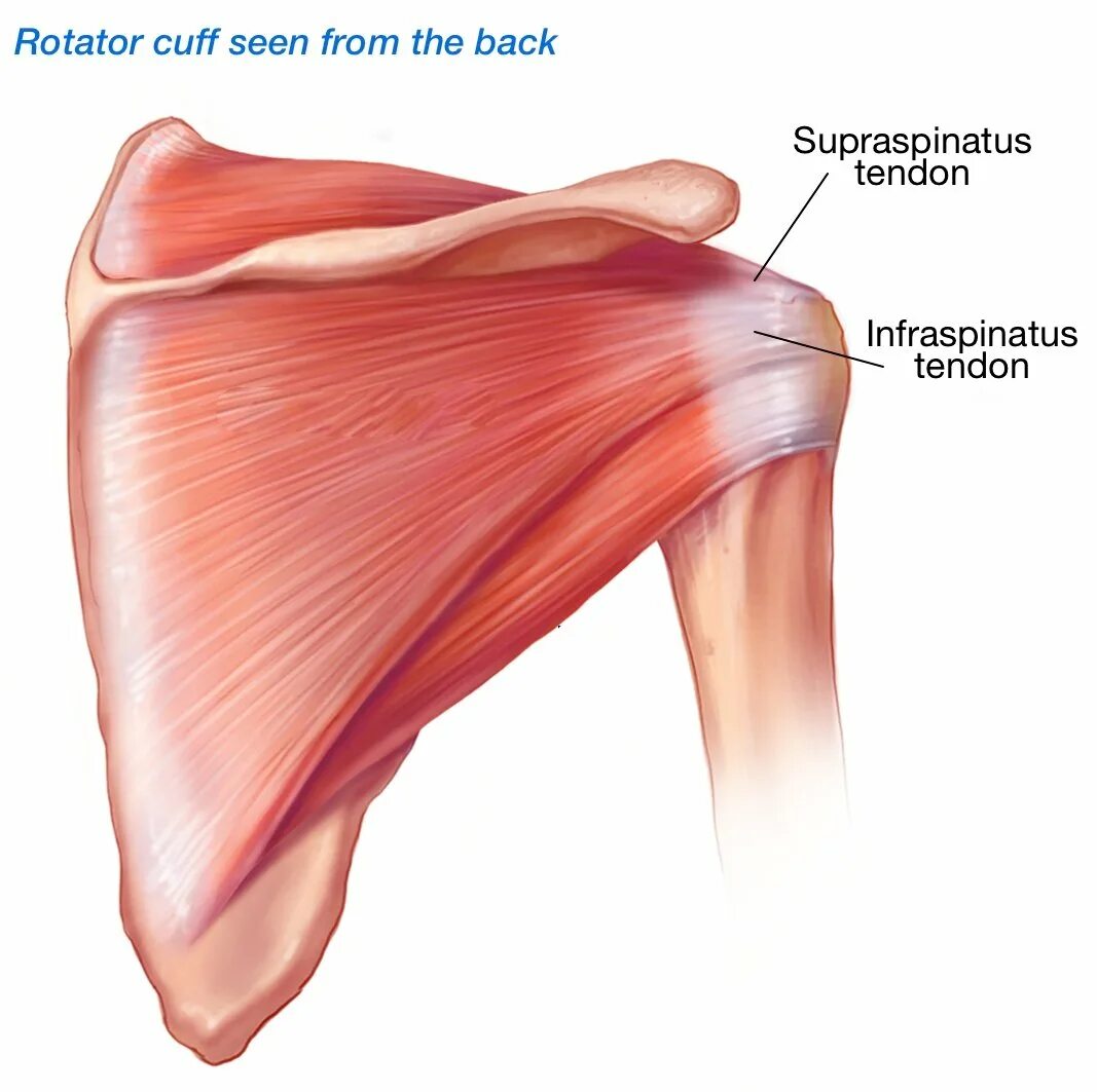 Повреждение сухожилия подлопаточной мышцы. Подостная мышца плечевого сустава. Подлопаточный бурсит плечевого. Надостная мышца (супраспинатус).. Сухожилие подостная мышца плеча.