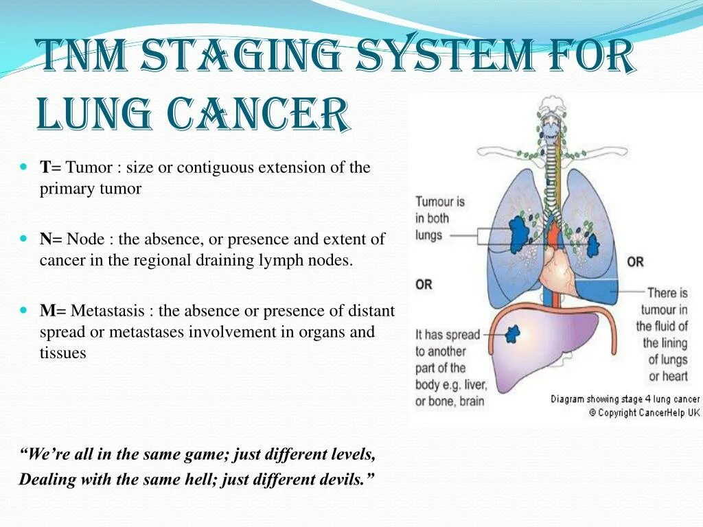 TNM 8 lung Cancer. Lung Cancer classification. TNM легкие. Система TNM. Stages of cancer