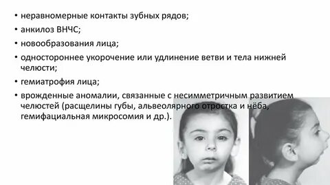 Неравномерное развитие ребенка