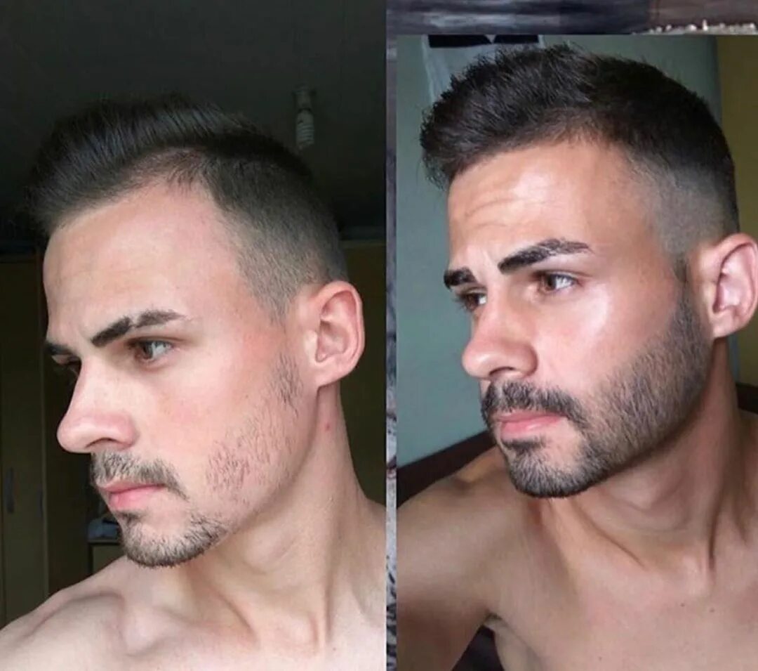 Рост волос на лице у мужчин. Миноксидил 5 для бороды. Миноксидил борода до и после. Мини ксидил 5% для бороды.