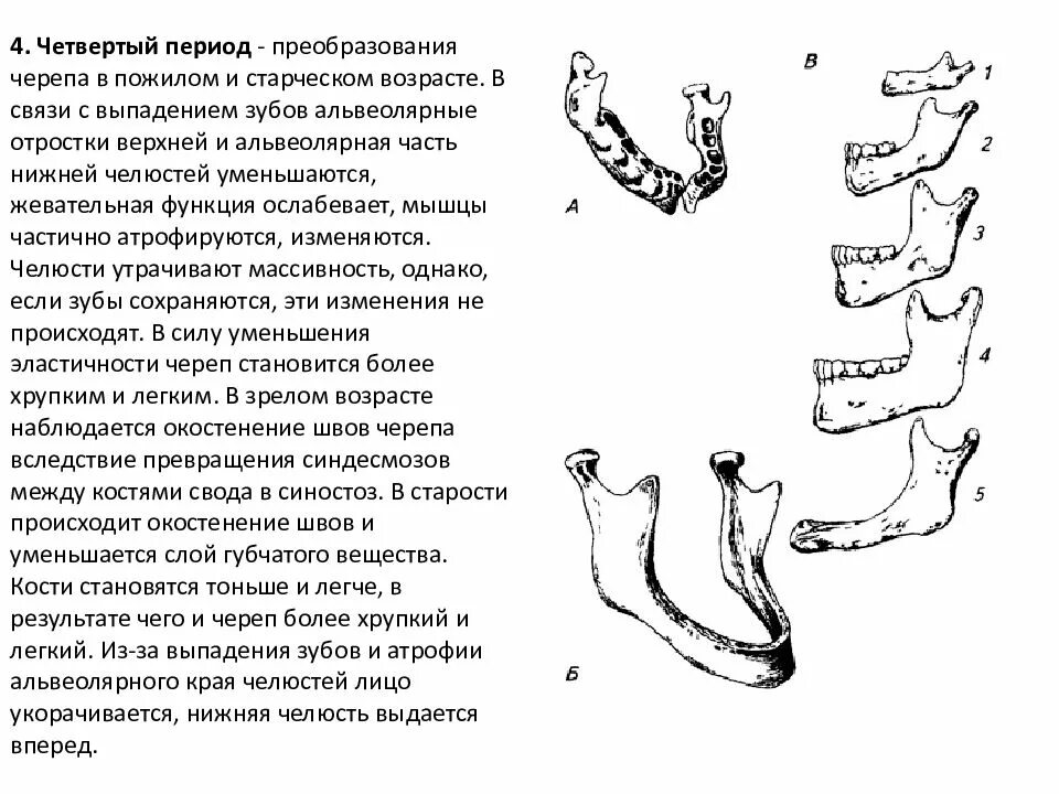 Атрофия челюстной кости. Старческое выпадение зубов. Четвертый период. К атрофии каких мышц приводит выпадение зубов.