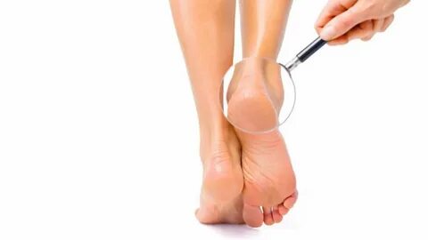 Foot collection