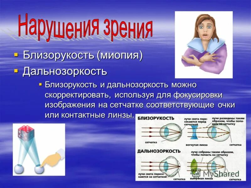 Как можно скорректировать дальнозоркость. Близорукость. Миопия и гиперметропия. Близорукость и дальнозоркость. Презентация на тему миопия.