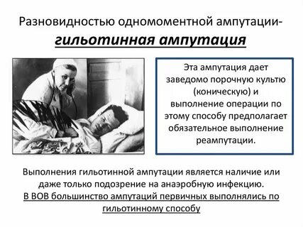 Код ампутации нижних конечностей