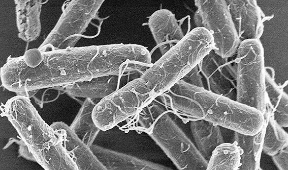 Бактерии клостридиум ботулинум. Ботулизм бактерия возбудитель. Клостридия ботулизма. Бактерия ботулизма. Бактерия ботулизма.