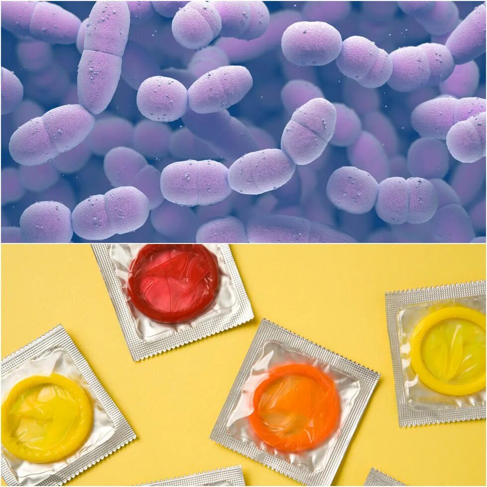 Chlamydia trachomatis mycoplasma genitalium. Микоплазмоз гениталиум. Mycoplasma genitalium (микоплазма гениталиум. Инфекция, вызванная Mycoplasma genitalium.