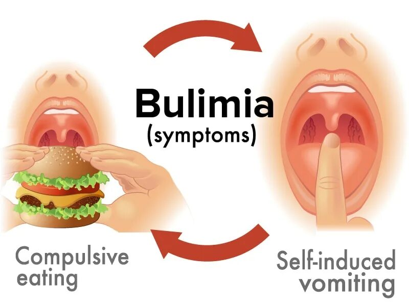 Рџљ eating disorder test