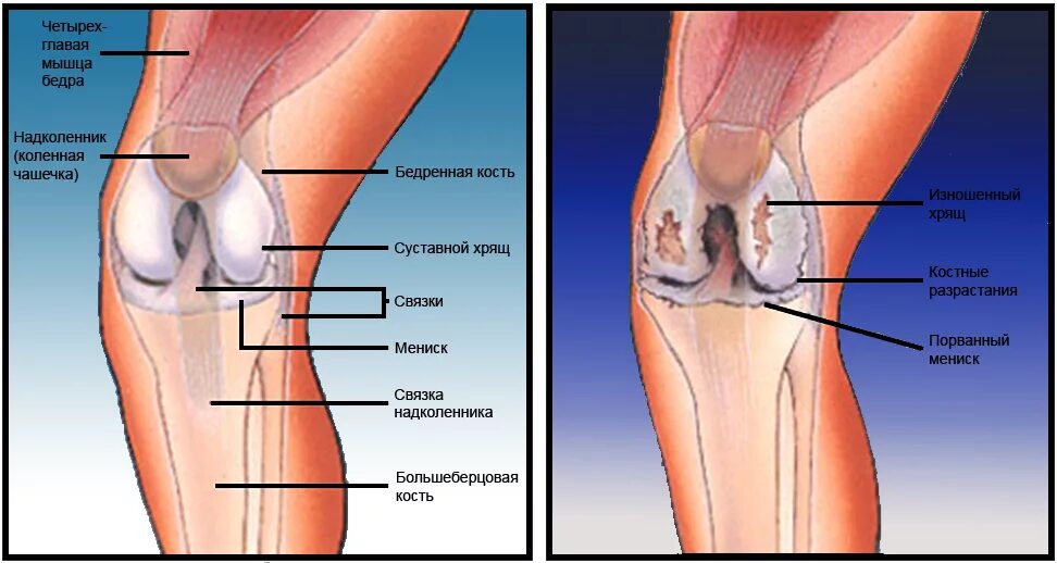 Боль под коленом спереди. Внутренняя сторона колена. Внутренняя сторона коленного сустава. Внутренн сторона колено. Болит колено с внутренней стороны.