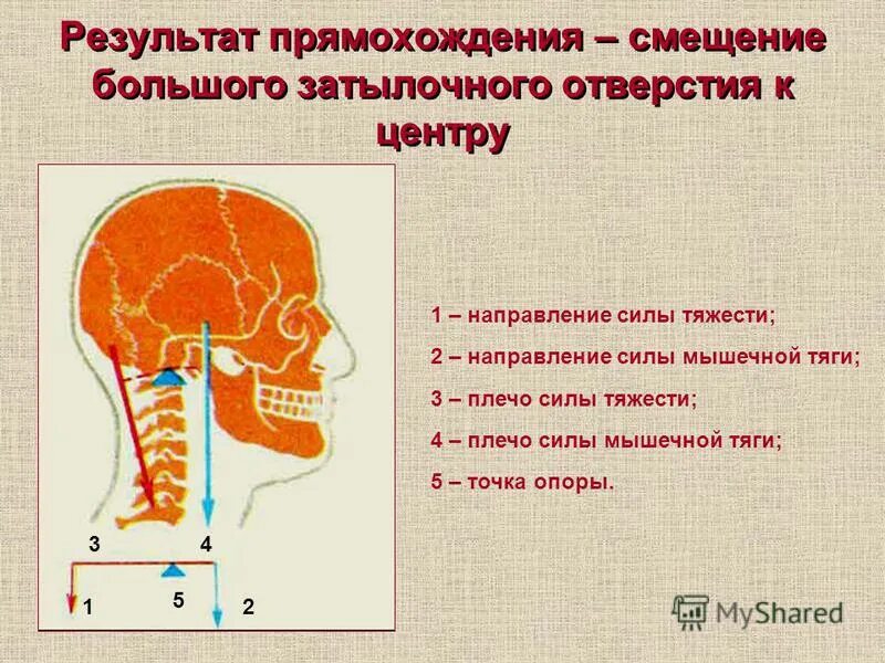 результат прямохождения человека. результат прямохождения человека. результат прямохождения человека. результат прямохождения человека. различия животных и человека.