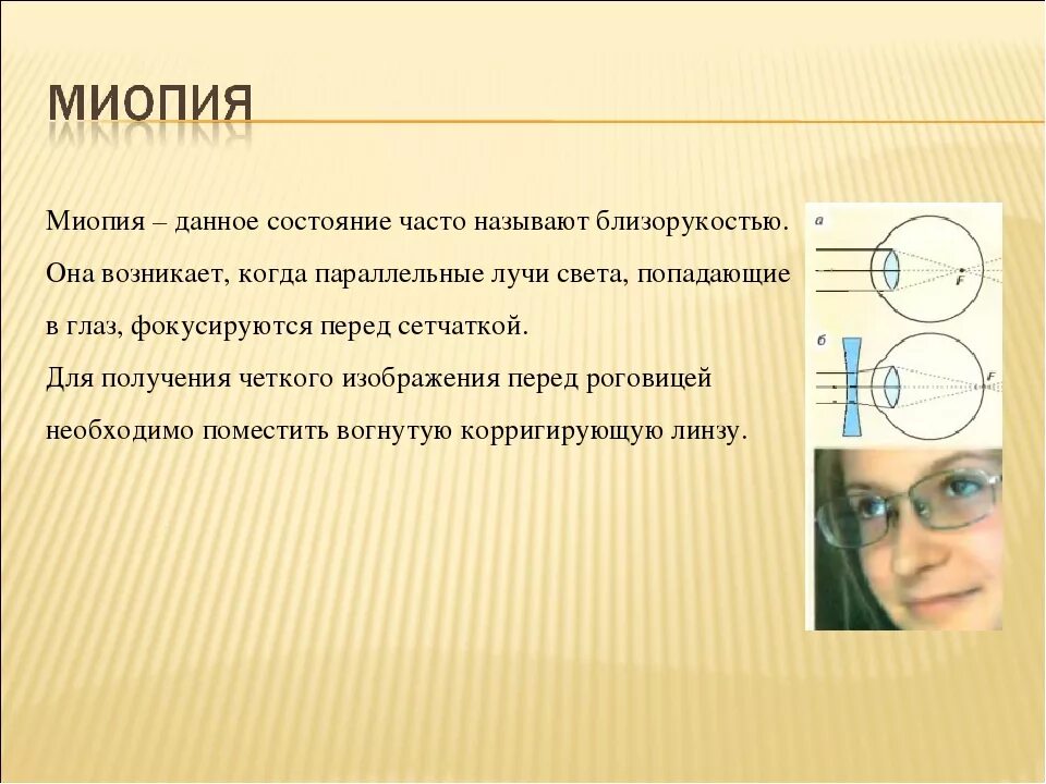 Слабая миопия глаза что. Миопия. Близорукость миопия. Близорукость слабой степени. Миопия слабой степени.