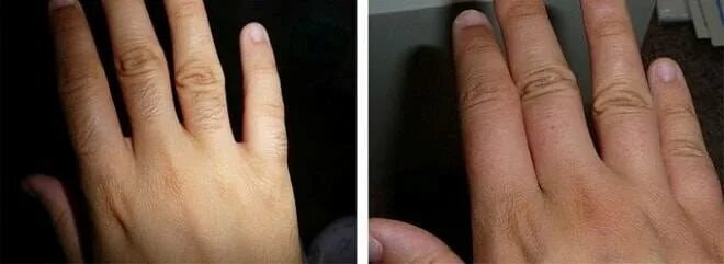 волосы на пальцах рук у девушек. вырос волос на подушечке пальца. волос на пальце у младенца. волосы на пальцах. волосы на пальцах.