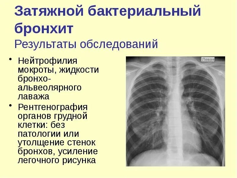 Усилен рисунок