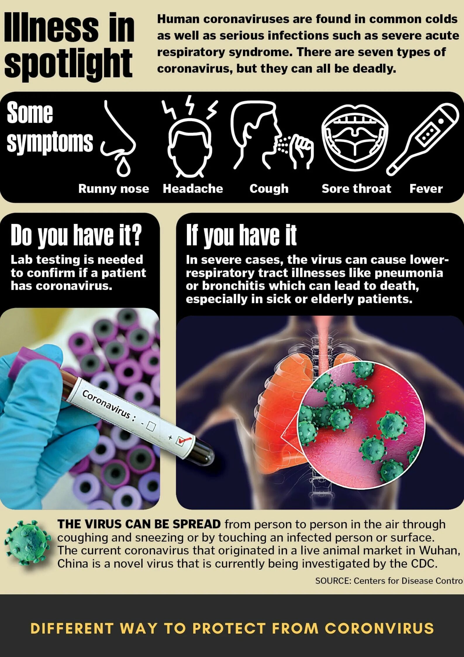 The virus can be. How to protect yourself from viruses. What can you do to you protect yourself from virus?. Coronavirus отзывы. How can you protect yourself from becoming infected with AIDS.