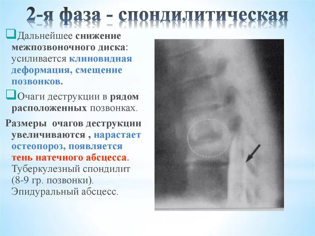 Высота дисков снижена